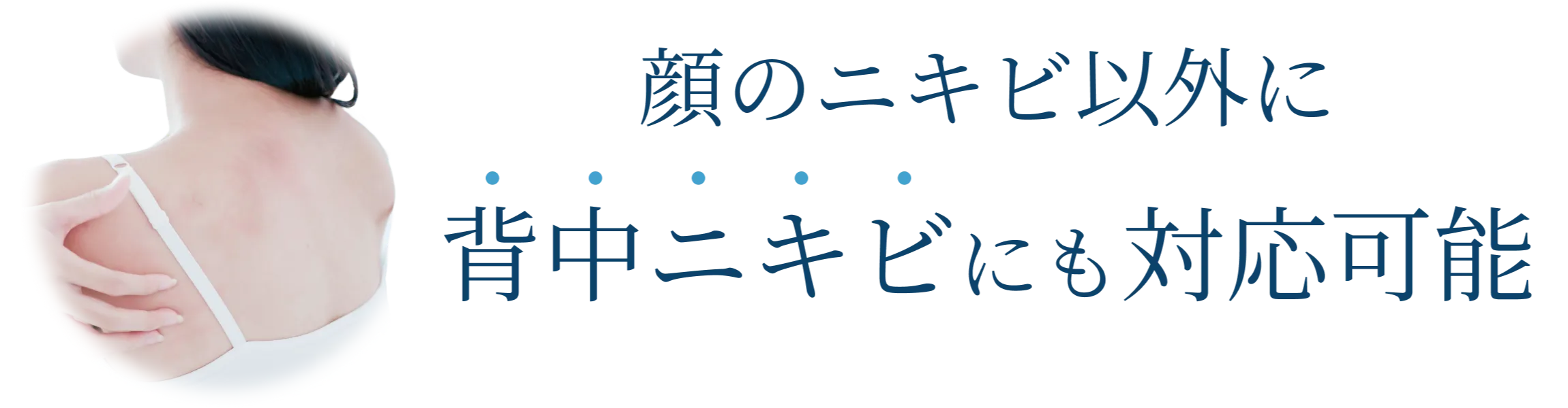 顔のニキビ以外に背中ニキビにも対応可能