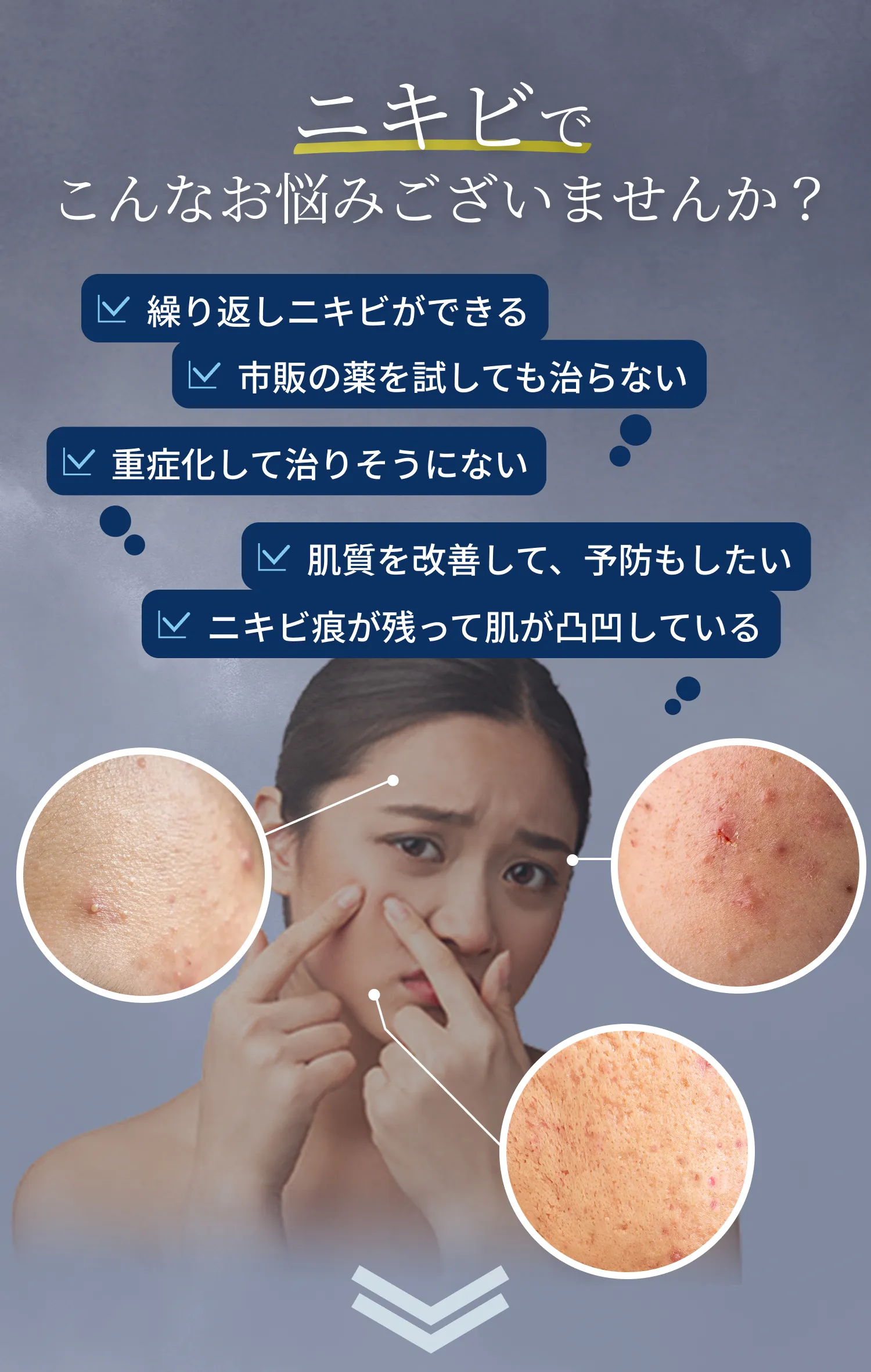 ニキビでこんなお悩みございませんか？繰り返しニキビができる。市販の薬を試しても治らない。重症化して治りそうにない。肌質を改善して予防もしたい。ニキビ痕が残って肌がでこぼこしてしている。