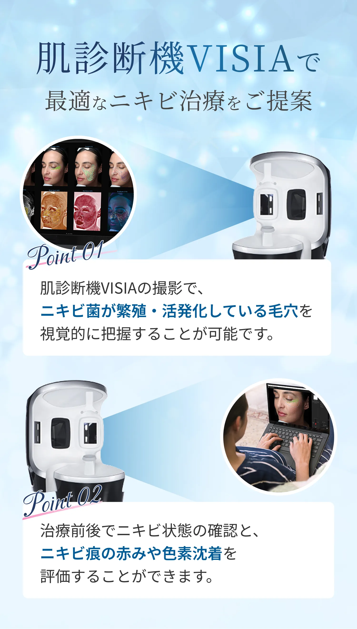 肌診断機VISIAで最適なニキビ治療をご提案