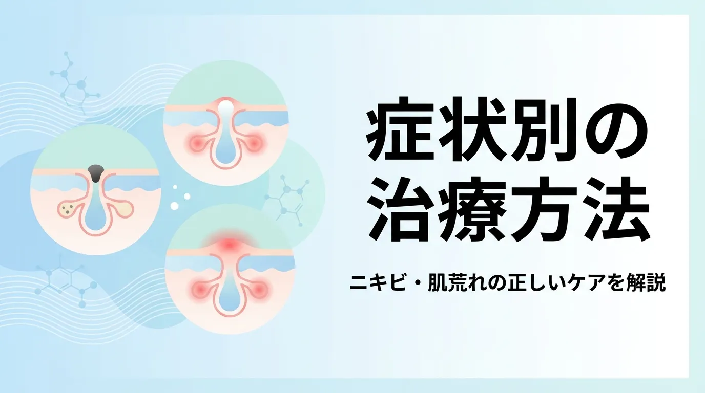 毛穴の状態を示すイラストと、種類や症状別のニキビ治療方法