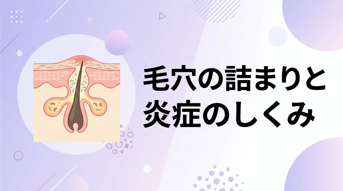 皮脂による毛穴の詰まりと炎症を示した、ニキビができる仕組みのイラスト