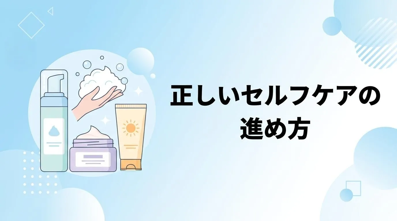 洗顔料や保湿剤、日焼け止めを使った自宅でのニキビケアを示すイラスト
