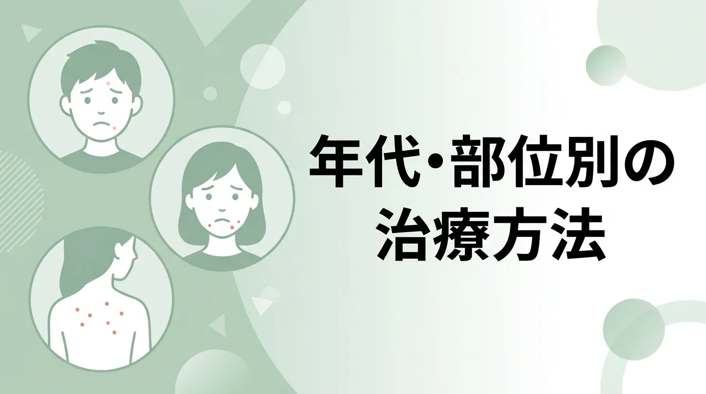 顔や背中のニキビを示した、年代・部位・悩み別のニキビ治療方法