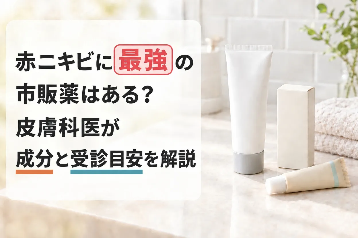 赤ニキビに最強の市販薬はある？皮膚科医が成分と受診目安を解説する記事のアイキャッチ画像