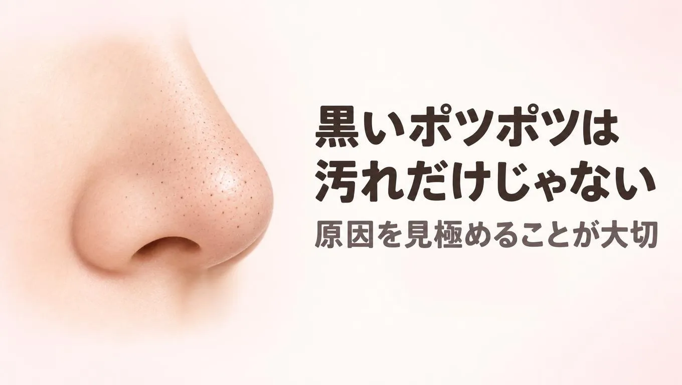 いちご鼻の特徴である鼻の毛穴の黒いポツポツを拡大したイメージ